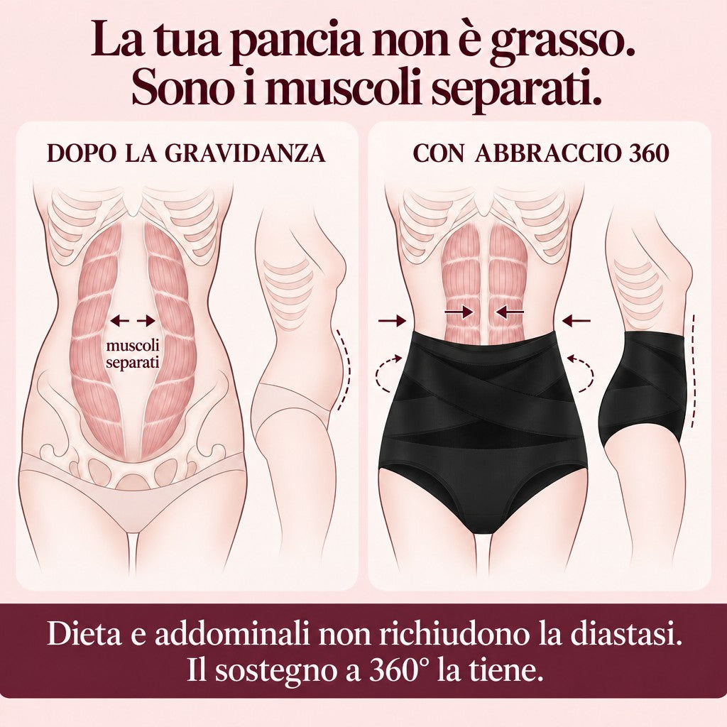 La pancia non è grasso, è la diastasi: come la sostiene Abbraccio 360