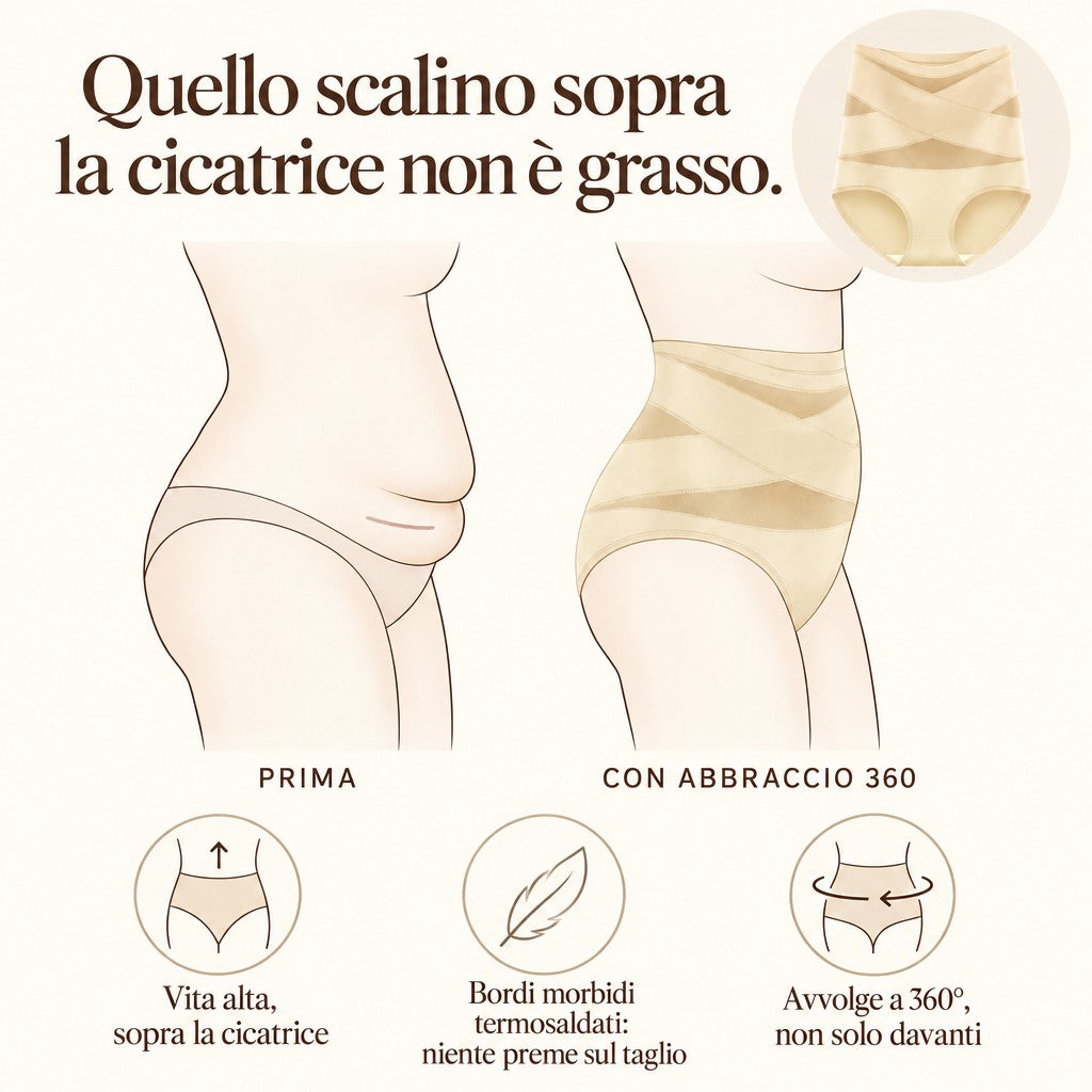Lo scalino sopra la cicatrice del cesareo: la vita alta sale sopra la cicatrice
